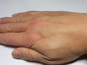 右手（塗布後）