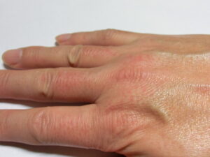 右手（2回目処理）