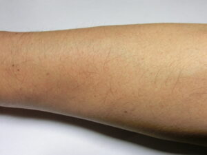 右腕('処理前）