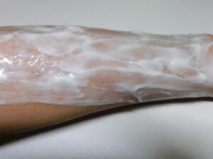 右腕（除毛クリーム塗布中）