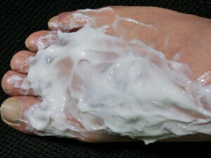 右足（除毛クリーム塗布中）