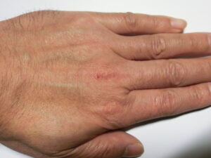 左手（使用前）