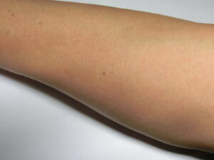 右腕（処理後）