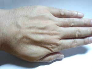 除毛剤「リムーバークリーム」