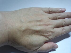 除毛剤「リムーバークリーム」