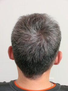 メンズスピーディ(白髪用)