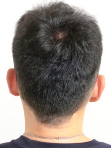 メンズスピーディ(白髪用)2