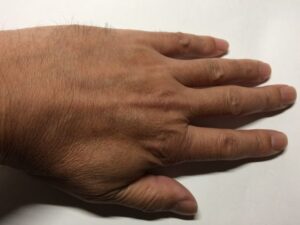 手の指の毛、手の甲の毛、腕の毛