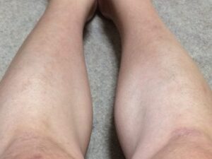 MONOVOヘアリムーバークリームでスネ毛を除毛