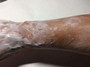 「MONOVOヘアリムーバークリーム」塗布中