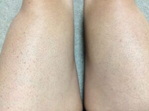 MONOVOヘアリムーバークリーム