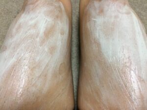 MONOVOヘアリムーバークリーム