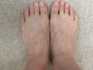 足の指毛・足の甲の毛